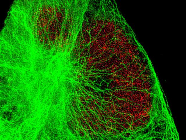 Electron Imaging Center for Nanomachines